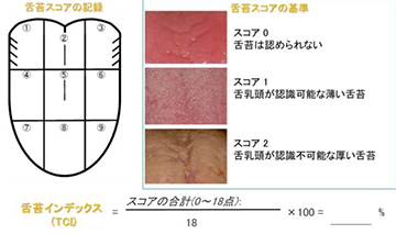 口腔衛生状態チェック